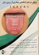 اولین مرجع تشخیص بیماری از روی زبان 2022